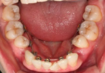 pro_tongue