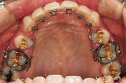 pro_tongue